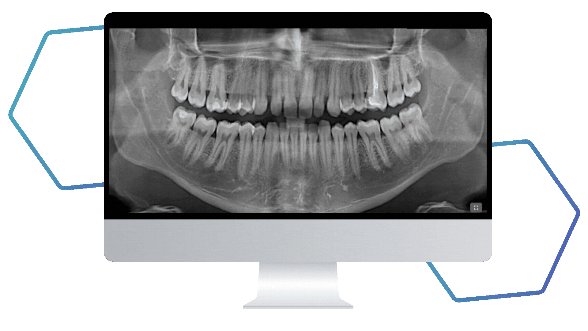 Teeth gif