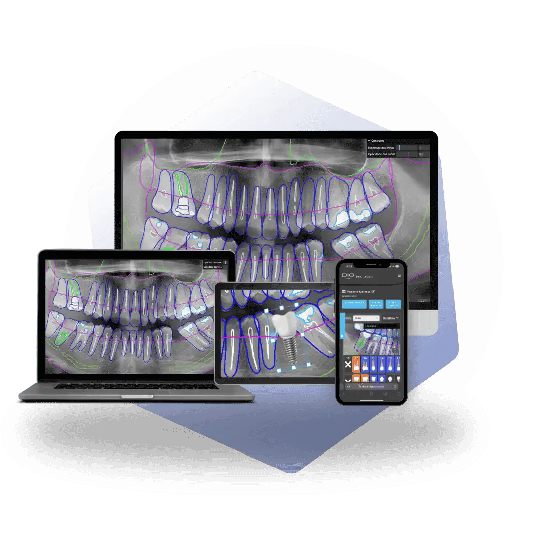 Devices